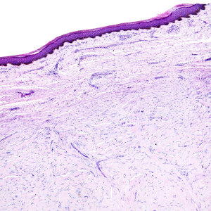 Microscope Skin
